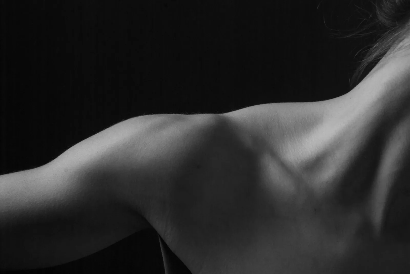 Rotator Cuff Injuries: Understanding the Role of Acupuncture